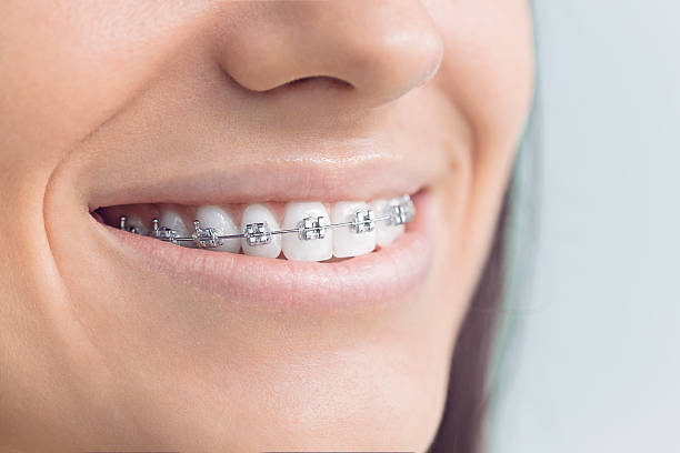 Best Tooth Extraction  in Burley, WA