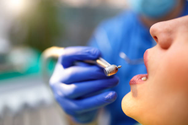 Laser Dentistry in Burley, WA